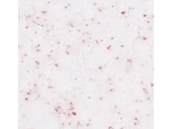 Terralith Buntsteinputz Mosaikputz 1mm -15 kg- BSP1126 Weiss Rot* Außen-Fassadenfarben